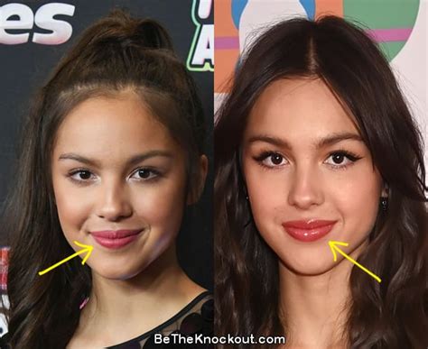 does olivia rodrigo have implants|Fans Are ‘Worried’ About Olivia Rodrigo Amid Plastic。